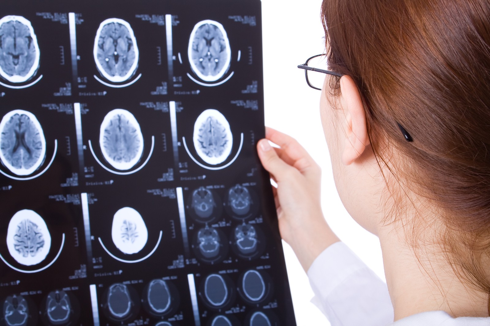 female doctor examines brain scans