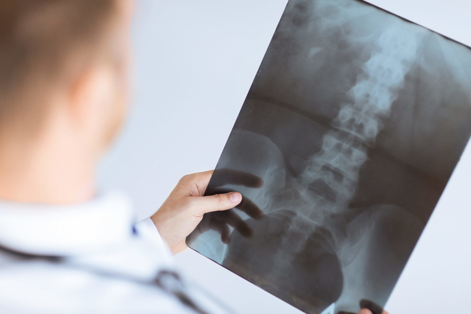 close up of male doctor holding x-ray or roentgen image